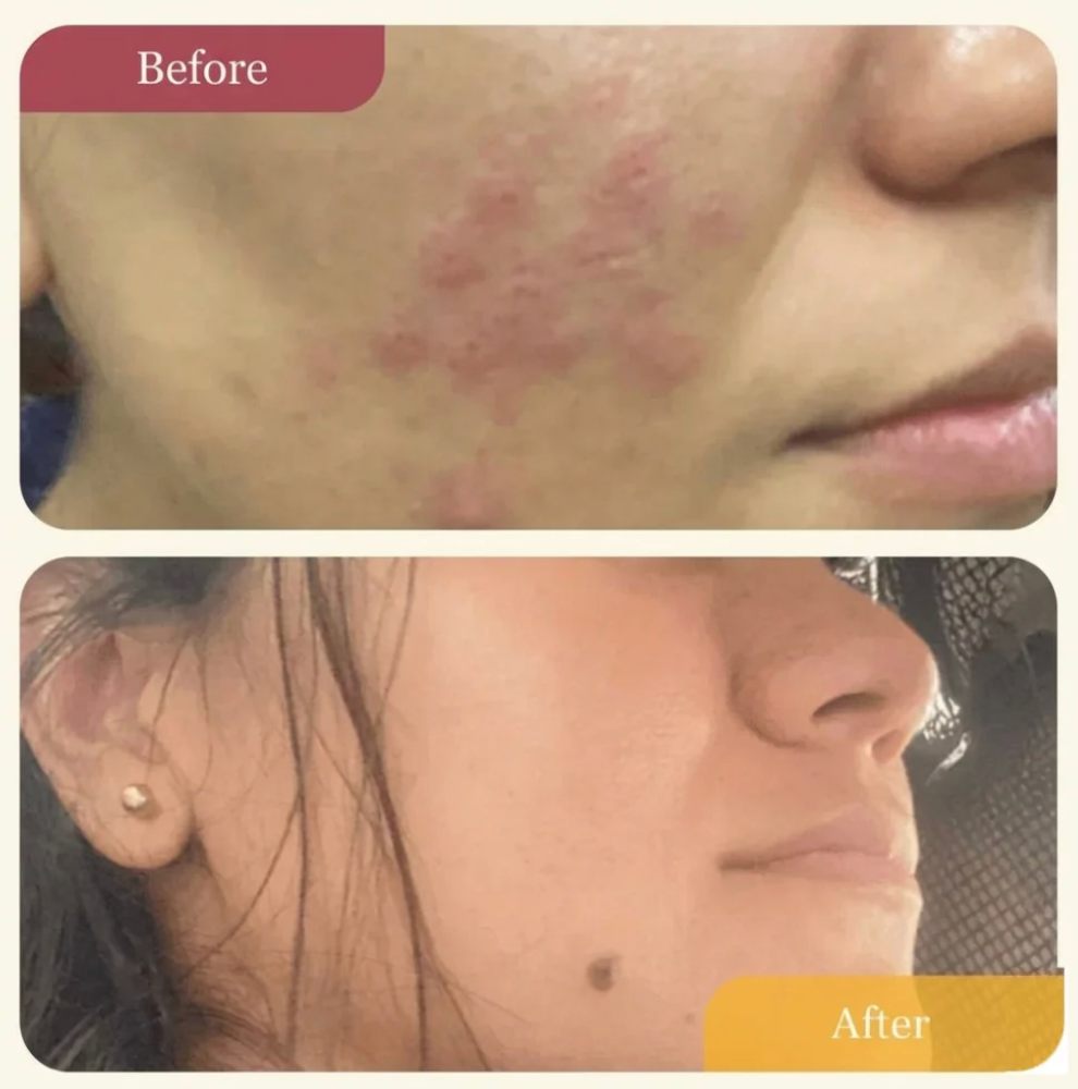 Refillable Clear Confidence Moisturizer